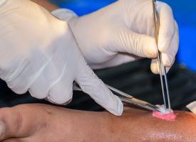 wound being dressed by doctor