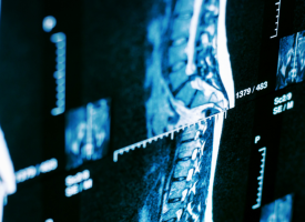 X-ray