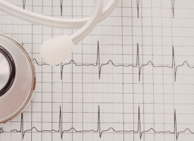 ECG