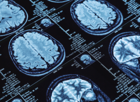radiology image 