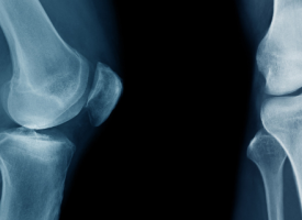 X-Ray